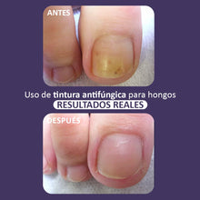 Spray tintura antifungica 50ML